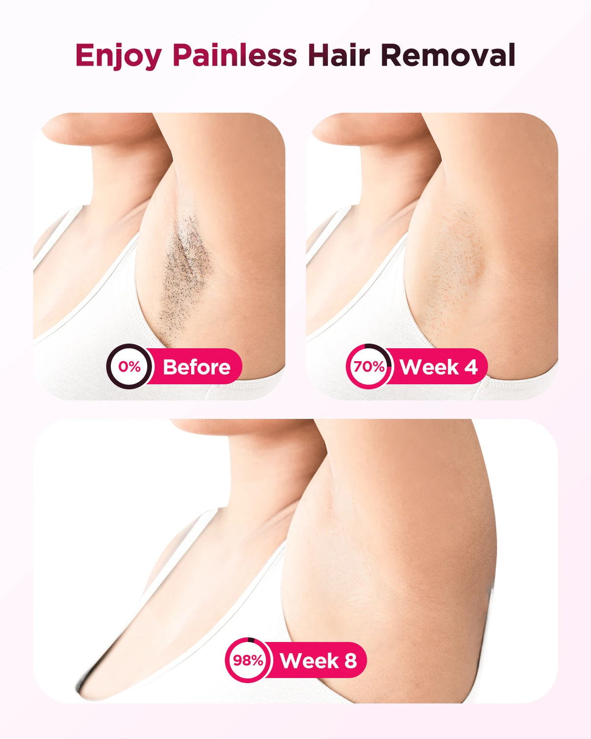 Supplier promotional hair reduction: 70 percent at week 4 and 98 percent at week 8; results vary