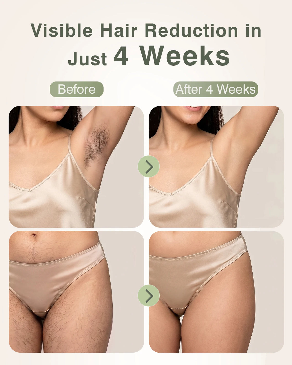 Supplier promotional illustration comparing hair appearance before and after four weeks; results vary